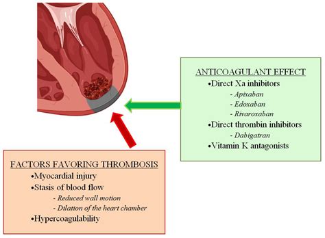 lv thrombi|left ventricular thrombus patient education.